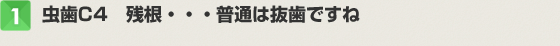 虫歯C4 残根…普通は抜歯ですね